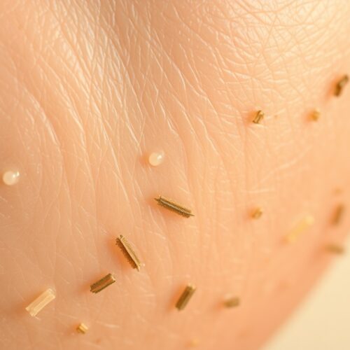 DSlibertarians | Профилактика остеопороза у женщин в менопаузе